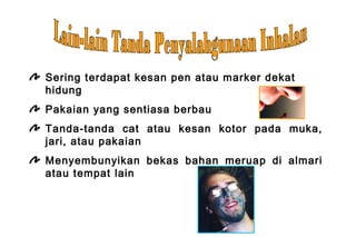 Sering terdapat kesan pen atau marker dekat
hidung
Pakaian yang sentiasa berbau
Tanda-tanda cat atau kesan kotor pada muka,
jari, atau pakaian
Menyembunyikan bekas bahan meruap di almari
atau tempat lain
 