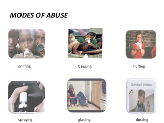 MODES OF ABUSE
sniffing bagging huffing
spraying glading dusting
 