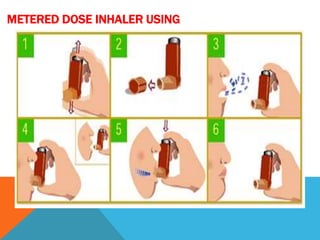 METERED DOSE INHALER USING
 