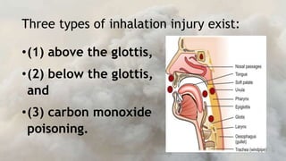 INHALATION-INJURY nursing lesson to prevent complications | PPTX