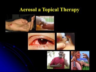 Aerosol a Topical Therapy
 