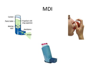 MDI
 