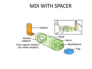 MDI WITH SPACER
 