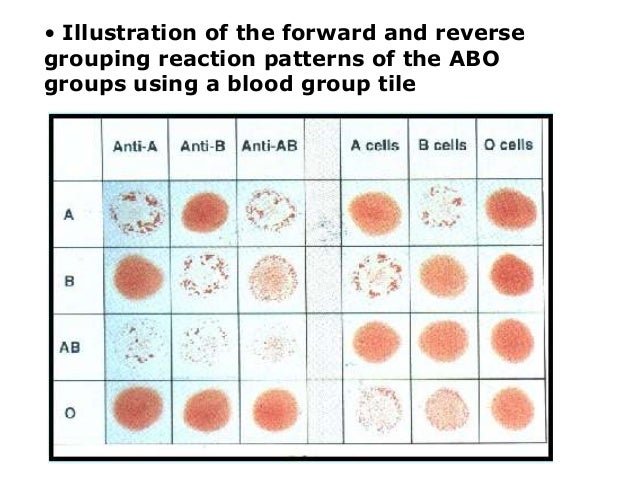 Blood Type Reaction Chart