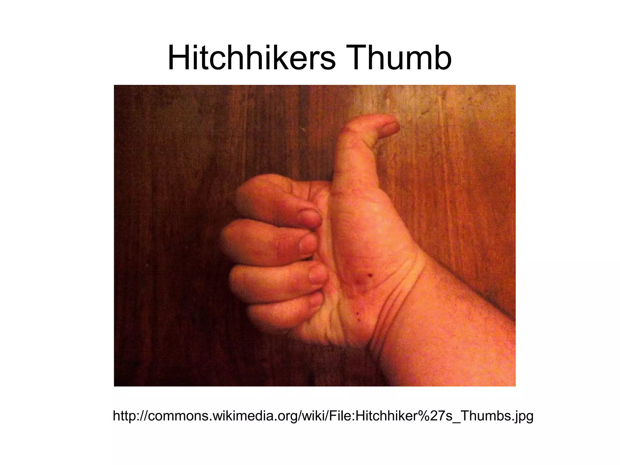 Hitchhikers Thumb




http://commons.wikimedia.org/wiki/File:Hitchhiker%27s_Thumbs.jpg
 