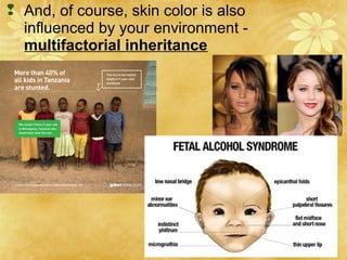  And, of course, skin color is also
influenced by your environment -
multifactorial inheritance
 