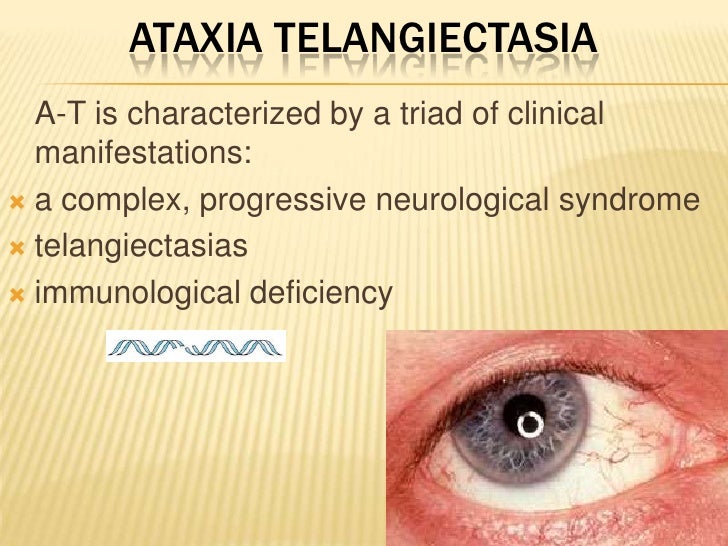 Lecture section...Inherited ataxias