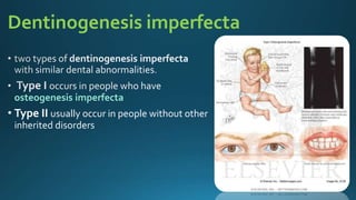 Dentinogenesis imperfecta
osteogenesis imperfecta
• Type II usually occur in people without other
inherited disorders
 
