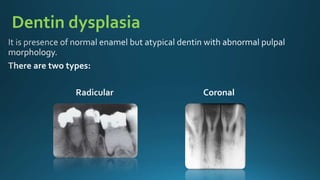Dentin dysplasia
 