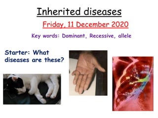 Inherited diseases
Starter: What
diseases are these?
Friday, 11 December 2020
Key words: Dominant, Recessive, allele
 