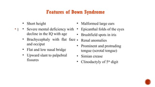 |
Features of Down Syndrome
• Short height
• Severe mental deficiency with
decline in the IQ with age
• Brachycephaly with flat face
and occiput
• Flat and low nasal bridge
• Upward slant to palpebral
fissures
• Malformed large ears
• Epicanthal folds of the eyes
• Brushfield spots in iris
• Renal anomalies
• Prominent and protruding
tongue (scrotal tongue)
• Simian crease
• Clinodactyly of 5th
digit
 