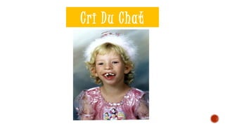 Cri Du Chat
 