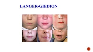 LANGER-GIEDION
 