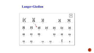 Langer-Giedion
 