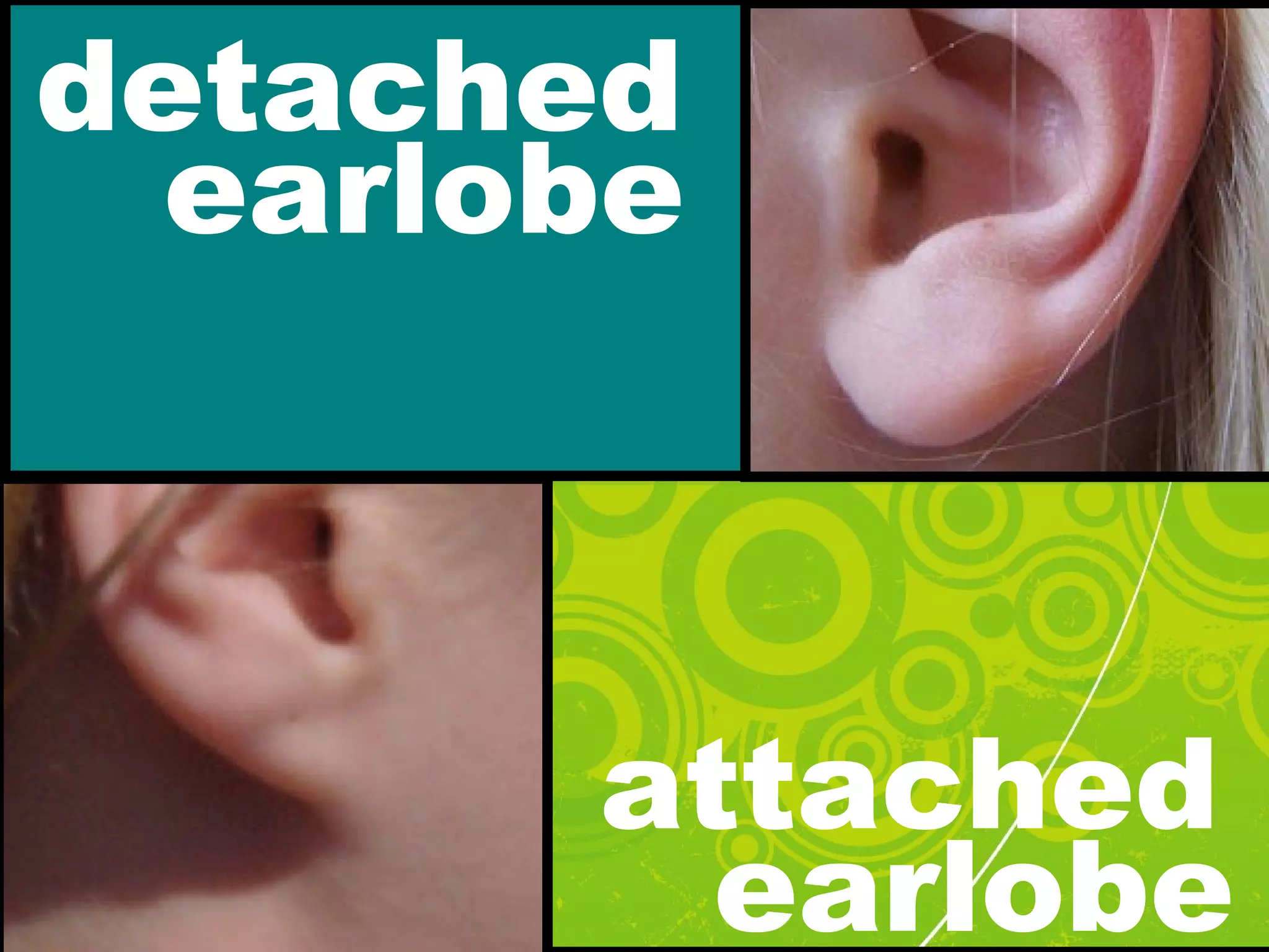 detached
earlobe
attached
earlobe
 