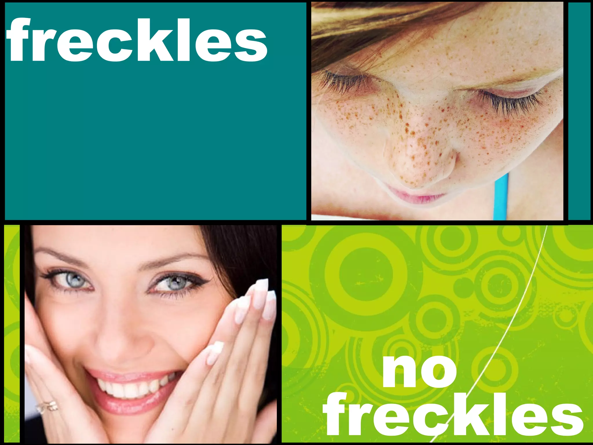 freckles
no
freckles
 