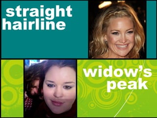 straight
peak
hairline
widow’s
 