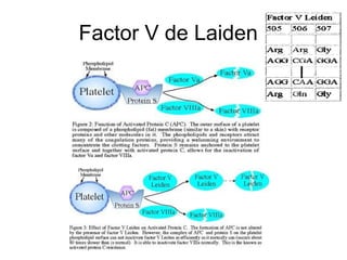 Factor V de Laiden
 
