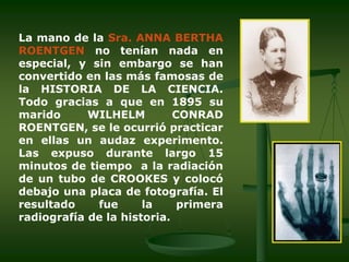 inicio de la radiologia1.ppt