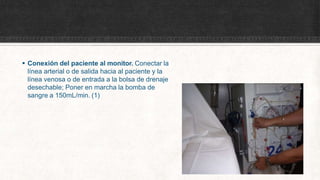  Conexión del paciente al monitor. Conectar la
línea arterial o de salida hacia al paciente y la
línea venosa o de entrada a la bolsa de drenaje
desechable; Poner en marcha la bomba de
sangre a 150mL/min. (1)
 
