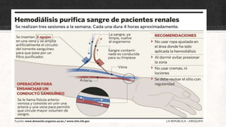 OBJETIVOS.
 Los objetivos de la hemodiálisis son:
 Extraer las sustancias nitrogenadas tóxicas de la sangre.
 Retirar el exceso de agua. (2)
 