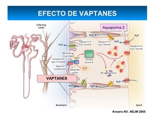 EFECTO DE VAPTANES
              Aquaporina 2




 VAPTANES




                   Knoers NV. NEJM 2005
 