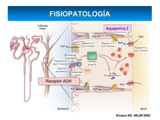 FISIOPATOLOGÍA
               Aquaporina 2




Receptor ADH




                    Knoers NV. NEJM 2005
 