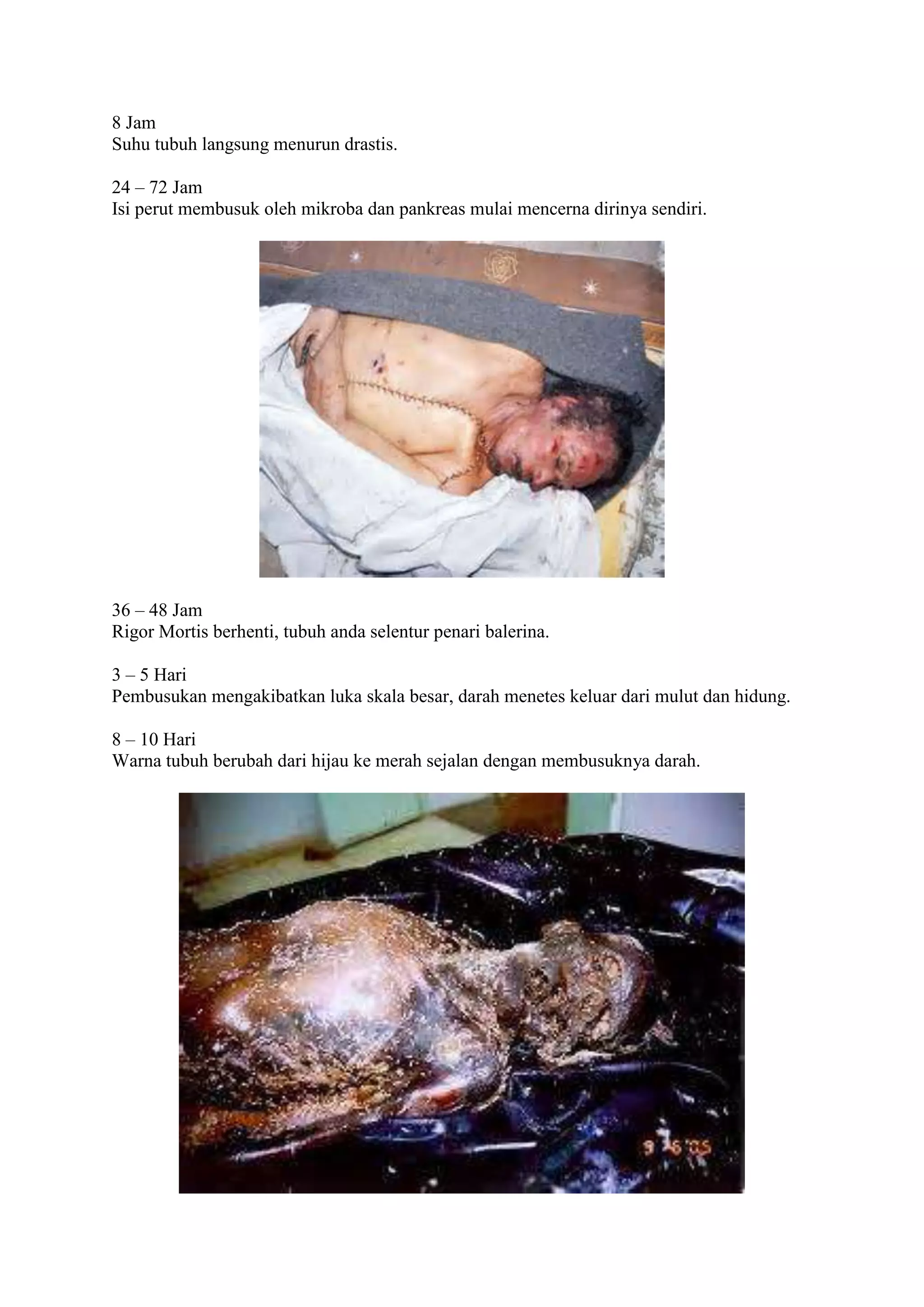 8 Jam
Suhu tubuh langsung menurun drastis.
24 – 72 Jam
Isi perut membusuk oleh mikroba dan pankreas mulai mencerna dirinya sendiri.
36 – 48 Jam
Rigor Mortis berhenti, tubuh anda selentur penari balerina.
3 – 5 Hari
Pembusukan mengakibatkan luka skala besar, darah menetes keluar dari mulut dan hidung.
8 – 10 Hari
Warna tubuh berubah dari hijau ke merah sejalan dengan membusuknya darah.
 