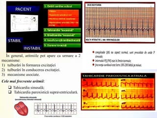 În general, aritmiile pot apare ca urmare a 2
mecanisme:
1) tulburări în formarea excitaţiei
2) tulburări în conducerea excitaţiei.
3) mecanisme asociate.
Cele mai frecvente aritmii:
 Tahicardia sinusalǎ;
 Tahicardia paroxisticǎ supraventricularǎ.
 
