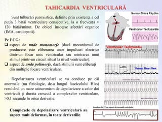 Sunt tulburări paroxistice, definite prin existenţa a cel
puţin 3 bătăi ventriculare consecutive, la o frecvenţă >
120 bătăi/minut. De obicei însoţesc afectări organice
(IMA, cardiopatii).
Pe ECG:
 aspect de unde monomorfe (dacă mecanismul de
producere este eliberarea unor impulsuri electrice
dintr-un focar unic ventricular sau reintrarea unui
stimul printr-un circuit situat la nivel ventricular);
 aspect de unde polimorfe, dacă stimulii sunt eliberaţi
din multiple focare ventriculare.
Depolarizarea ventriculară se va conduce pe căi
anormale (nu fiziologic, de-a lungul fascicolului Hiss)
rezultând un mare asincronism de depolarizare a celor doi
ventriculi şi durata crescută a complexelor ventriculare,
>0,1 secunde în orice derivaţie.
Complexele de depolarizare ventriculară au
aspect mult deformat, în toate derivatiile.
 