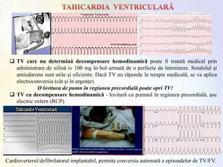  TV care nu determină decompensare hemodinamică poate fi tratată medical prin
administrare de xilină iv 100 mg în bol urmată de o perfuzie de întretinere. Sotalolul şi
amiodarona sunt utile şi eficiente. Dacă TV nu răpunde la terapie medicală, se va aplica
electroconversia (cât şi în urgenţe).
O lovitura de pumn în regiunea precordială poate opri TV!
 TV cu decompensare hemodinamică - lovitură cu pumnul în regiunea precordială, şoc
electric extern (RCP).
Cardioverterul/defibrilatorul implantabil, permite conversia automată a episoadelor de TV/FV.
 
