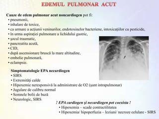 Cauze de edem pulmonar acut noncardiogen pot fi:
• pneumonii,
• inhalare de toxice,
• ca urmare a acţiunii veninurilor, endotoxinelor bacteriene, intoxicaţiilor cu pesticide,
• în urma aspiraţiei pulmonare a lichidului gastric,
• şocul traumatic,
• pancreatita acută,
• CID,
• după ascensionare bruscă la mare altitudine,
• embolie pulmonară,
• eclampsie.
Simptomatologie EPA necardiogen
• SIRS
• Extremităţi calde
• Hipoxemie neresponsivă la administrare de O2 (şunt intrapulmonar)
• Jugulare de calibru normal
• Semnele bolii de bază
• Neurologic, SIRS
! EPA cardiogen şi necardiogen pot coexista !
• Hipoxemia – scade contractilitatea
• Hipoxemia/ hipoperfuzia – leziuni/ necroze celulare - SIRS
 
