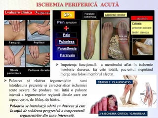  Paloarea şi răcirea tegumentelor sunt
întotdeauna prezente şi caracteristice ischemiei
acute severe. Se produce mai întâi o paloare
intensă a tegumentelor regiunii distale care are
aspect ceros, de fildeş, de hârtie.
 Impotenţa funcţională a membrului aflat în ischemie
însoţeşte durerea. Ea este totală, pacientul neputând
merge sau folosi membrul afectat.
Paloarea se instalează odată cu durerea şi este
însoţită de scăderea progresivă a temperaturii
tegumentelor din zona interesată.
 