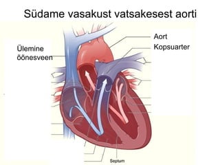 Südame vasakust vatsakesest aorti Aort Kopsuarter Ülemine  õõnesveen 