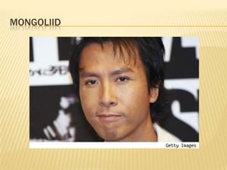 MONGOLIID
 