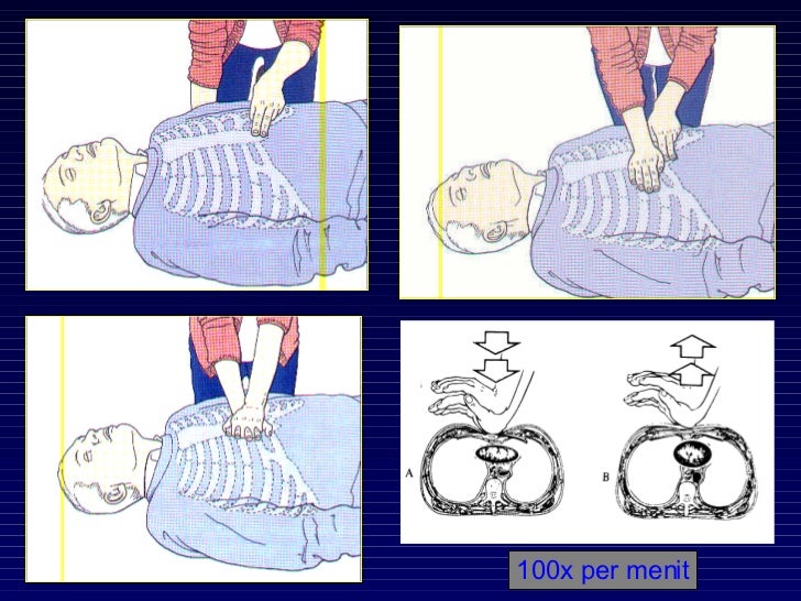 Initial Assessment pada gawat darurat