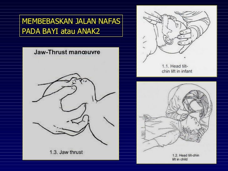 Initial Assessment pada gawat darurat