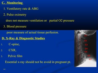 C. Monitoring
1. Ventilatory rate & ABG
2. Pulse oximetry
does not measure ventilation or partial O2 pressure
3. Blood pressure
poor measure of actual tissue perfusion.
D. X-Ray & Diagnostic Studies
1. C-spine,
2. CXR,
3. Pelvic film
Essential x-ray should not be avoid in pregnant pt.
C1
C2
C3
C5
C6
C7
C4
 