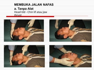 MEMBUKA JALAN NAFAS
a. Tanpa Alat
Head tild - Chin lif atau Jaw
thrust
 