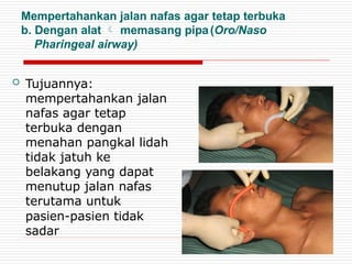 Mempertahankan jalan nafas agar tetap terbuka
b. Dengan alat  memasang pipa(Oro/Naso
Pharingeal airway)
 Tujuannya:
mempertahankan jalan
nafas agar tetap
terbuka dengan
menahan pangkal lidah
tidak jatuh ke
belakang yang dapat
menutup jalan nafas
terutama untuk
pasien-pasien tidak
sadar
 