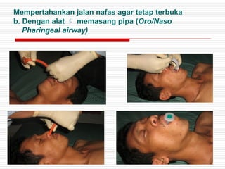 Mempertahankan jalan nafas agar tetap terbuka
b. Dengan alat  memasang pipa (Oro/Naso
Pharingeal airway)
 