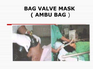 BAG VALVE MASK
( AMBU BAG )
 