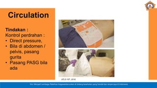 Visi: Menjadi Lembaga Pelatihan Kegawatdaruratan di bidang kesehatan yang handal dan terpercaya di Indonesia
Tindakan :
Kontrol perdrahan :
• Direct pressure,
• Bila di abdomen /
pelvis, pasang
gurita
• Pasang PASG bila
ada
Circulation
ATLS 10th, 2018
 