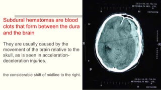 Accelaration Injries Initial Management of the Trauma Patient II.pptx