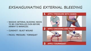 EXSANGUINATING EXTERNAL BLEEDING
• MASSIVE ARTERIAL BLEEDING NEEDS
TO BE CONTROLLED EVEN BEFORE
AIRWAY IS MANAGED.
• GUNSHOT/ BLAST WOUND
• PACKS/ PRESSURE/ TORNIQUET
 