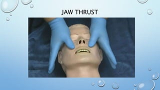 JAW THRUST
 