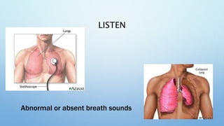 LISTEN
Abnormal or absent breath sounds
 