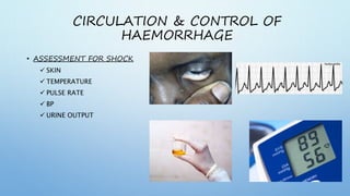 CIRCULATION & CONTROL OF
HAEMORRHAGE
• ASSESSMENT FOR SHOCK
 SKIN
 TEMPERATURE
 PULSE RATE
 BP
 URINE OUTPUT
 