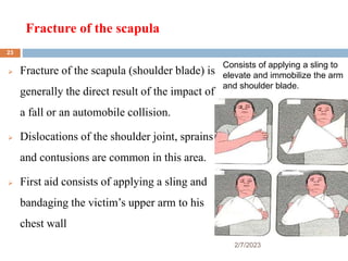 Fracture of the scapula
2/7/2023
 Fracture of the scapula (shoulder blade) is
generally the direct result of the impact of
a fall or an automobile collision.
 Dislocations of the shoulder joint, sprains
and contusions are common in this area.
 First aid consists of applying a sling and
bandaging the victim’s upper arm to his
chest wall
Consists of applying a sling to
elevate and immobilize the arm
and shoulder blade.
23
 