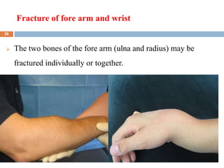 Fracture of fore arm and wrist
2/7/2023
 The two bones of the fore arm (ulna and radius) may be
fractured individually or together.

26
 